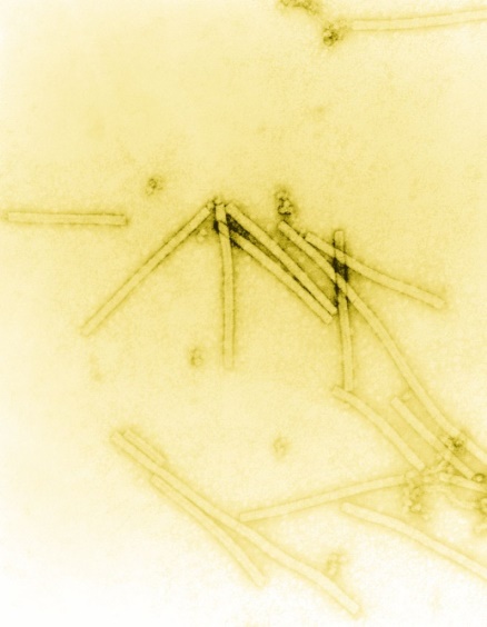 Virus khảm thuốc lá – Wikipedia tiếng Việt