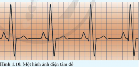 Tim co bóp theo nhịp do được điều khiển bằng một hệ thống các xung điện dẫn truyền trong cơ tim. Máy điện tim ghi nhận những xung điện này và hiển thị dưới dạng đường điện tâm đồ....