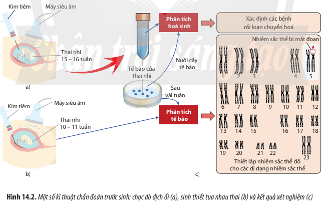 BÀI 14. DI TRUYỀN HỌC NGƯỜI