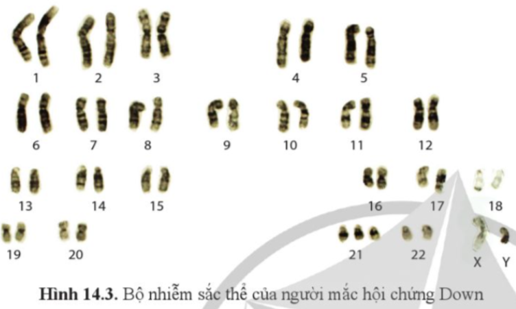 BÀI 14. DI TRUYỀN HỌC NGƯỜI