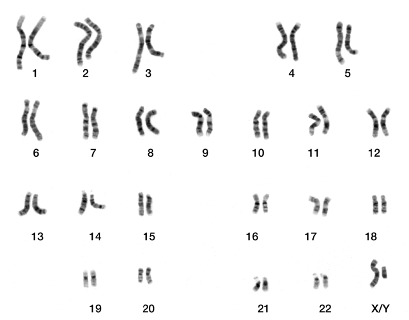 CHỦ ĐỀ 11: DI TRUYỀNBÀI 41: CẤU TRÚC NHIỄM SẮC THỂ VÀ ĐỘT BIẾN NHIỄM SẮC THỂ