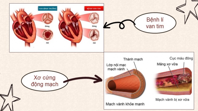 Soạn giáo án điện tử sinh học 11 CTST Bài 10: Tuần hoàn ở động vật (P2)