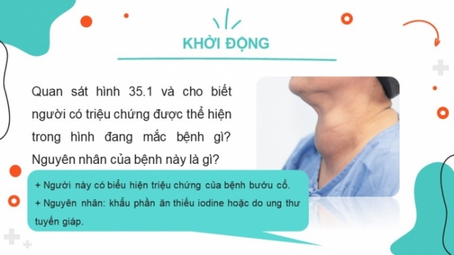 Soạn giáo án điện tử KHTN 8 CD Bài 35: Hệ nội tiết ở người