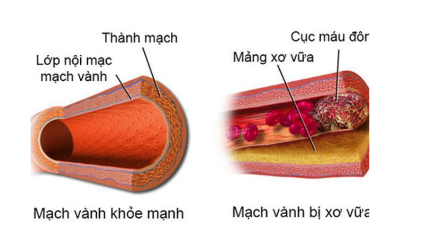 Bệnh về hệ tuần hoàn