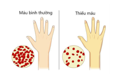 Bệnh về hệ tuần hoàn